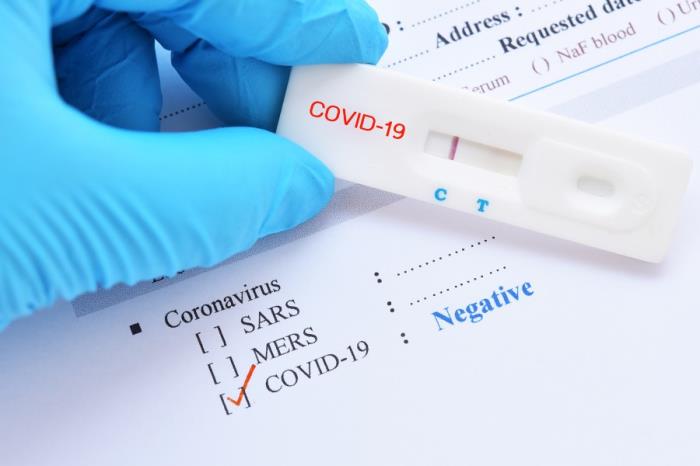 Aptar CSP Technologies Awarded $19 Million Government Contract to Expand Production Capacity for its Activ-Film Technology Used in COVID-19 Test Kits